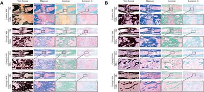 Cyclic Distraction–Compression Dynamization Technique Enhances the Bone Formation During Distraction Osteogenesis